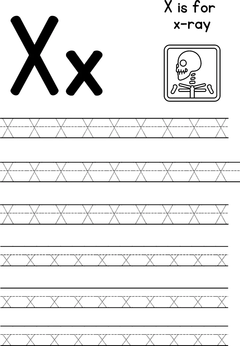 Large letters X and x beside a skeleton x-ray picture, with rows of dotted letters to trace below.